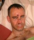 Martin Sewell drinking accident